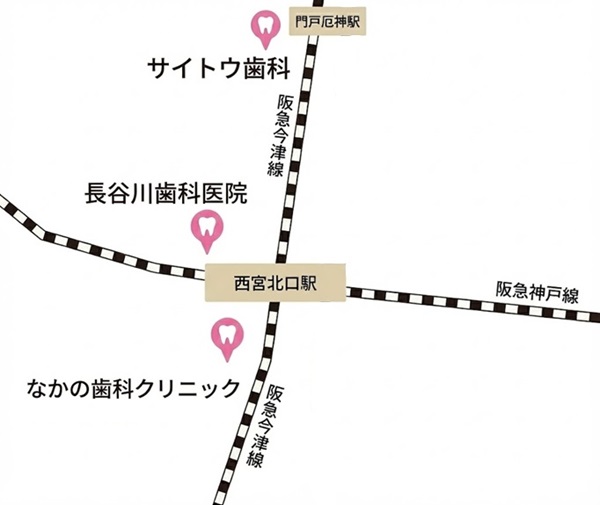 西宮でおすすめのインプラント歯科3院のマップ